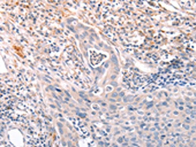 A4GNT Antibody