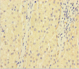 KDR Antibody