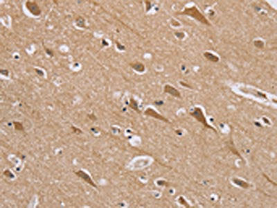 RAB6C Antibody