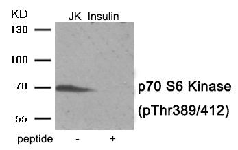Phospho-RPS6KB1 (Thr389/412) Antibody