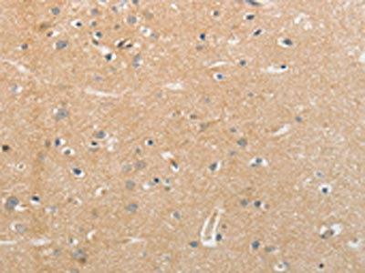 NFASC Antibody