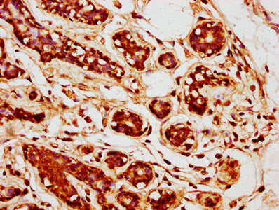 TGFB2 Antibody