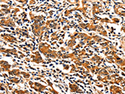 ITGAM Antibody
