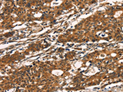 KLRC1 Antibody