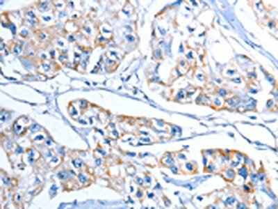 ADSL Antibody