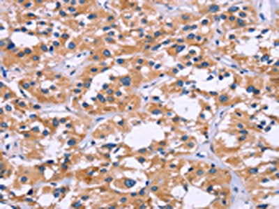 ZEB2 Antibody
