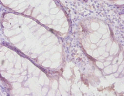 TIMP4 Antibody