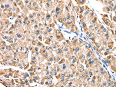 LTB4R2 Antibody