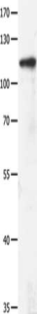 GRM3 Antibody