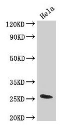 TNF Antibody
