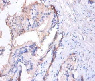 MMP7 Antibody