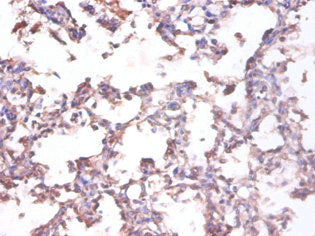 TNFSF10 Antibody