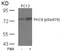 Phospho-PRKCQ (Ser676) Antibody