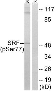 Phospho-SRF (Ser77) Antibody