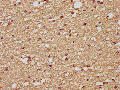 PLAUR Antibody