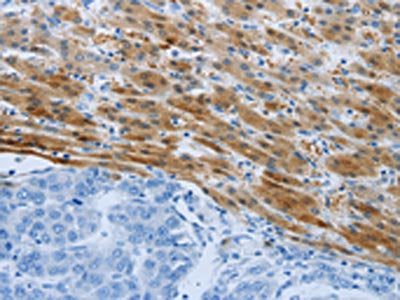 PSMD11 Antibody