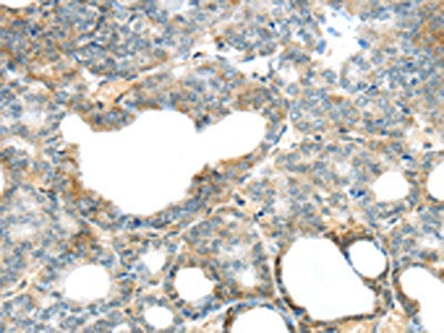 SERPINB11 Antibody