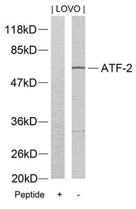 ATF2 (Ab-73 or 55) Antibody