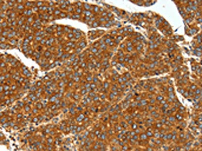 SSTR1 Antibody