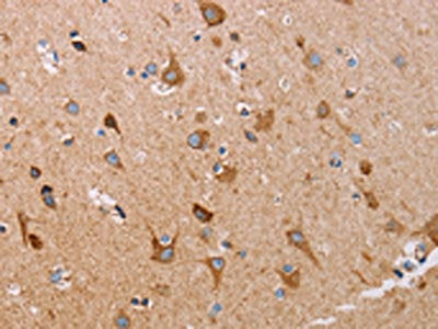 ATP5J Antibody