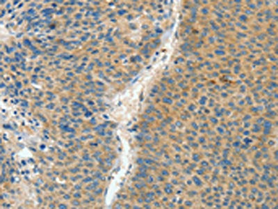 ASPA Antibody