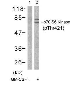 Phospho-RPS6KB1 (Thr421) Antibody