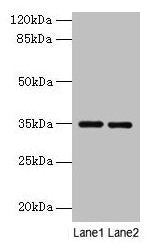 Thpo Antibody