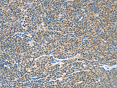ATF2 Antibody