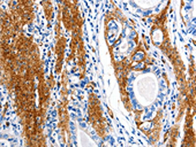 AQP1 Antibody
