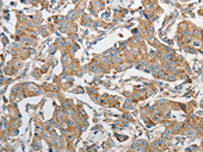 PRMT5 Antibody