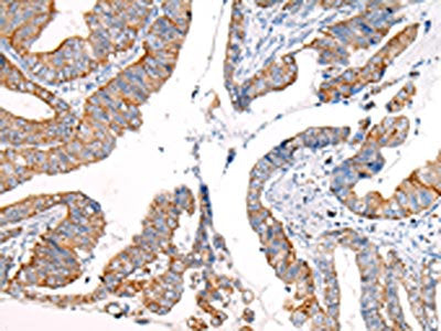 KRT7 Antibody