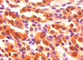 FABP3 Antibody