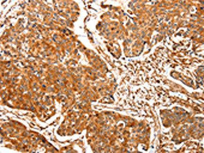 TPM2 Antibody