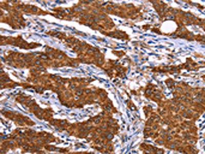 RPS6KA6 Antibody