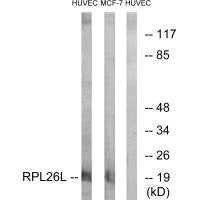 RPL26L1 Antibody