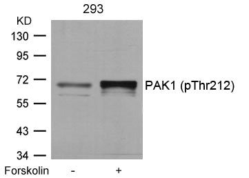 Phospho-PAK1 (Thr212) Antibody