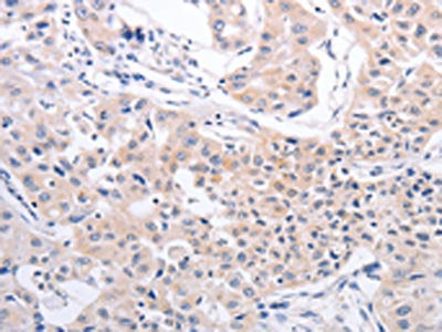 PFN4 Antibody