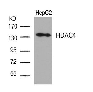 HDAC4 (Ab-632) Antibody
