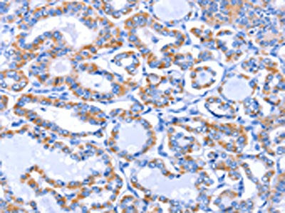 GJB3 Antibody
