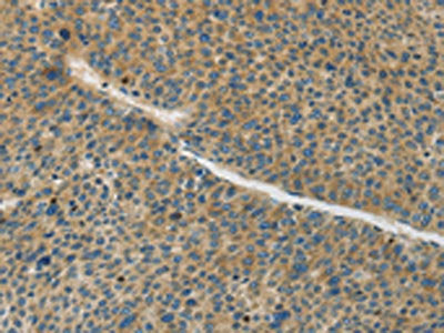 GJC1 Antibody