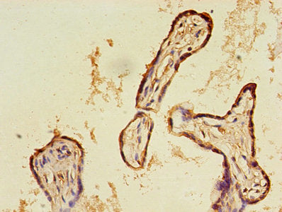 CALR Antibody