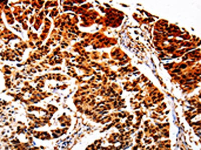 AKR1B1 Antibody