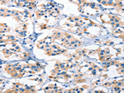 AHR Antibody
