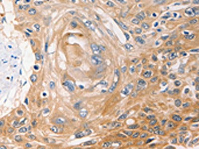 NME1 Antibody