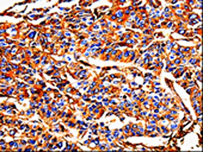ALB Antibody