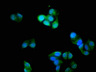 TNNI3 Antibody