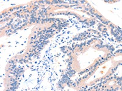 ITGA6 Antibody