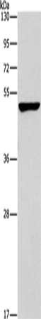 CALCRL Antibody