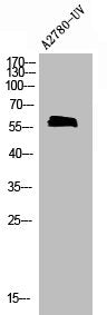Phospho-CDC25A (S75) Antibody
