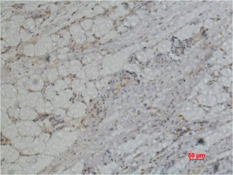 PRDX1 Antibody